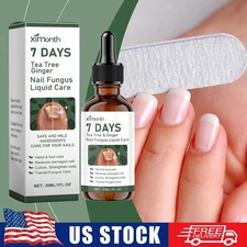 Ginger Nail-Treatment Nail-Care, Nail-Growth Oil for Cuticle Nourishment US