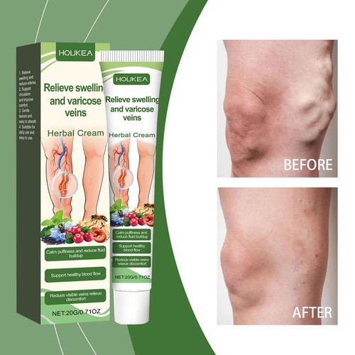 Leg Anti-Oedema Cream -Muscle Swelling Relief Massage Cream - 20g Foots Care❀ - Bild 3 von 11