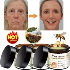 Bee Venom Skin Tag Removal Treatment Cream Body Care Mole Corn Wart Remover-2025