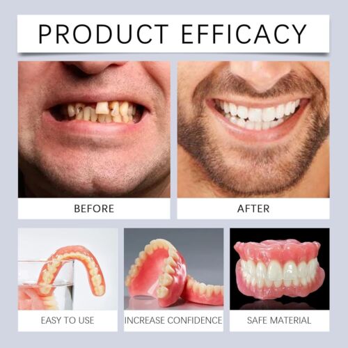 Advanced Customized Full Denture Set, Silicone Reline Denture Set, - Picture 11 of 21