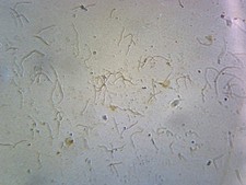 Leptospira (Spirochetes); Smear
