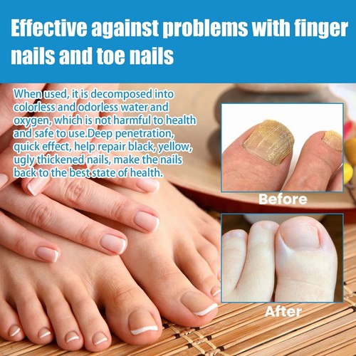 Nail Care Spray Nourishes The Skin And Nails, Improves Appearance And Odor,100ml - Picture 8 of 8