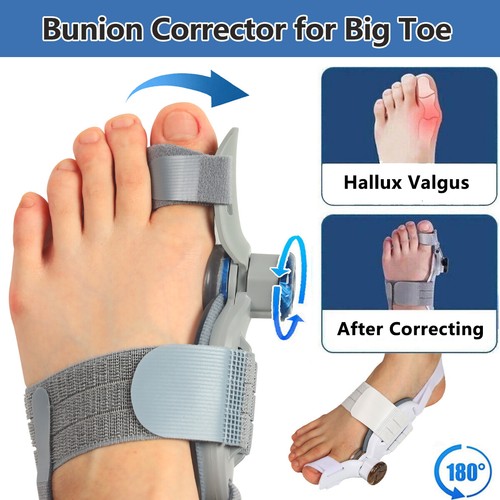 Hallux Valgus Support Big Toe Ballen Glätteisen Schiene Korrektor Schmerzlinderung 2 - Bild 1 von 19