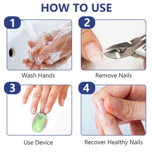 Fungus Nail Laser Device Red Blue Light Therapy Onychomycosis Nails Treatment US - Picture 20 of 45