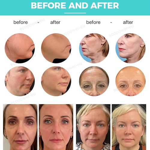 Facail Skin Tightening Magnetic Muscle Stumilator Face Wrinkle Removal Machine - Foto 15 di 16