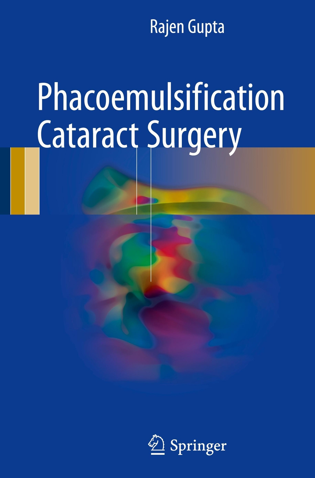 Thumbnail - Phacoemulsification Cataract Surgery | Rajen Gupta | Englisch | Buch |