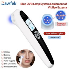 308nm UVB Light Therapy for Eczema Treatment Portable with Goggles 35mW/cm
