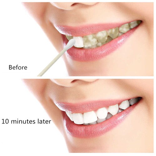 Teeth Whitening Gel Pen Extra Strong White Hygiene Tooth Whitener Stain Removal- - Picture 11 of 12