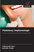 Podstawy Implantologii Korzy¿Ci I Wskazania Implantologii Stomatologicznej Buch