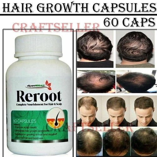 Professional Extra Strength Hair Growth Treatment Vitamin 60 Capsule for Women - Picture 6 of 10