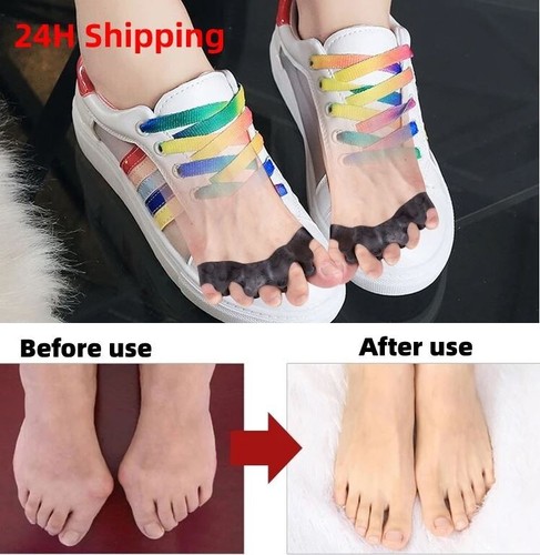 Silicone Gel Bunion Corrector Toe Separator Spreader Pain Relief Hallux Valgus - Picture 2 of 10