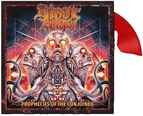 Discos de vinilo de la autopsia