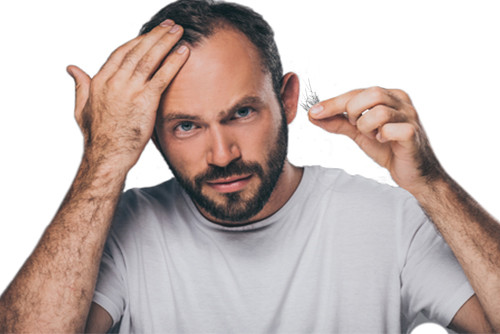 NISIM THINNING HAIR LOSS TREATMENT with ANAGAIN BEST FOR OILY SCALP MEN & WOMEN - Picture 5 of 8