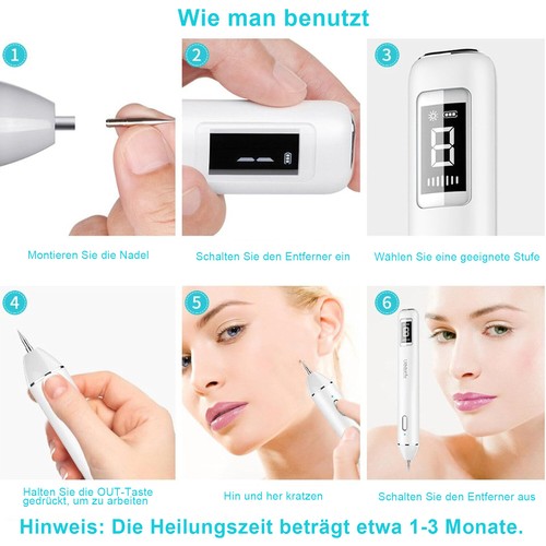 Laser+ Muttermal Entfernen Stift Plasma Pen Warzen Entfernen Mole Entfernung Pen - Bild 10 von 13