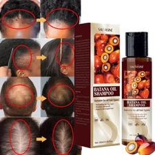 Batana Oil Hair Growth Cream, Natural Botana Oil Shampoo For Hair Loss Treatment