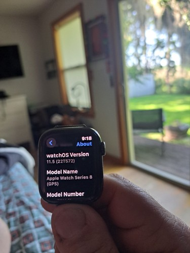 Apple Watch Series 8 MNUX3LL/A 8th Gen 41mm Aluminum WiFi GPS 4G LTE Starlight - Photo 4 sur 7