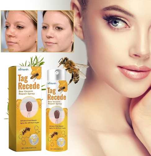 20g Bottle Skin Tag Bee Venom Spray, Wart Removal, Acne, Psoriasis Treatment - Picture 8 of 11