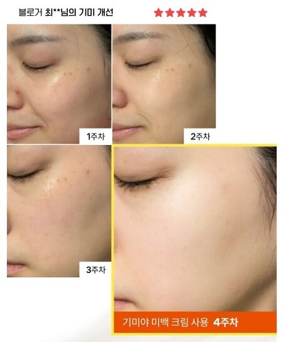 TONYMOLY Gimiya Whitening Cream 50g Powerful Freckle Removal Cream KOREA MADE - Picture 8 of 12
