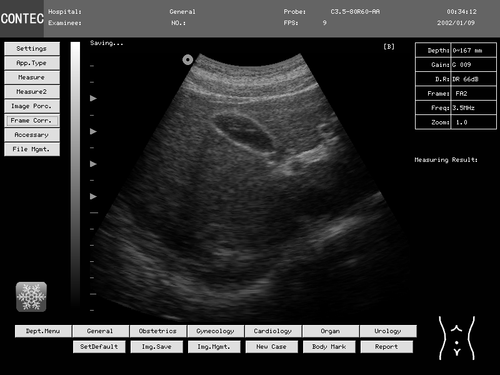 Human/VET Ultrasound Scanner Portable Laptop Machine Digital Probe, Factory Sale - Picture 15 of 32