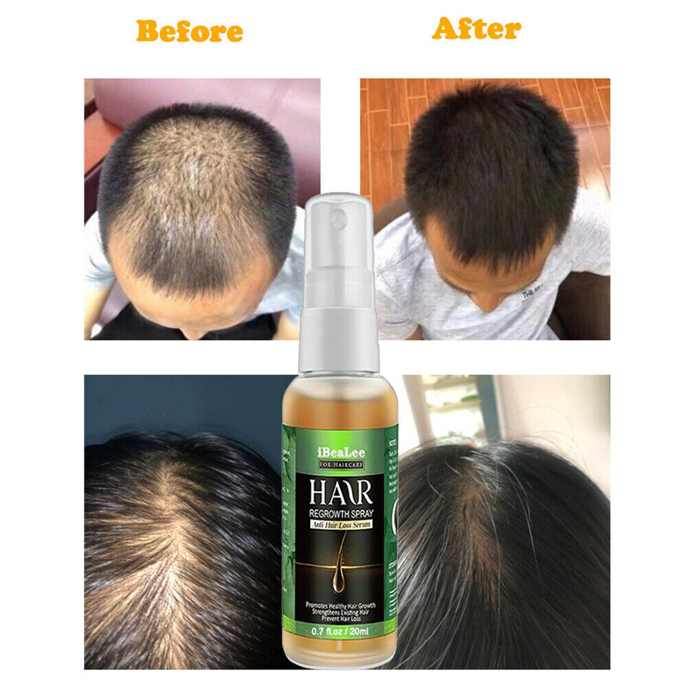 HyunGang Korea Ginseng Hair Regrowth Serum Spray-7 Days Ginger Hair Growth HOT | eBay HyunGang Korea Ginseng Hair Regrowth Serum Spray-7 Days Ginger Hair Growth HOT | eBay