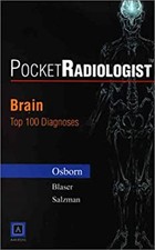 Brain : Top 100 Diagnoses Paperback Anne G. Osborn