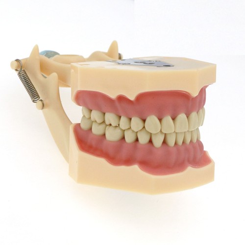 Dental Typodont Zahnmodell Implantat Pathologisch Perio Restauration Praxis Demo - Bild 274 von 312