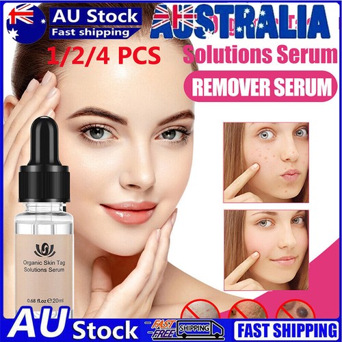 20g Organic Tags Solutions Serum Painless Face Warts Mole Skin Dark Spot Remover