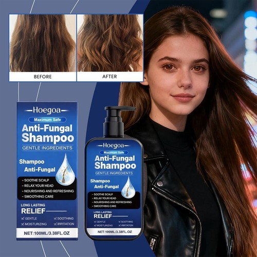 Anti Schuppen Shampoo 100 ml – Beruhigt die Kopfhaut vor beugt Schuppen und D7W6 - Picture 6 of 15