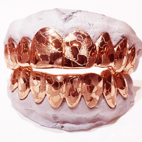 PARRILLA REAL HECHA A MANO DE PLATA ESTERLINA ENCHAPADA EN ORO ROSA CORTE PEPITA AJUSTE PERSONALIZADO - Imagen 1 de 7