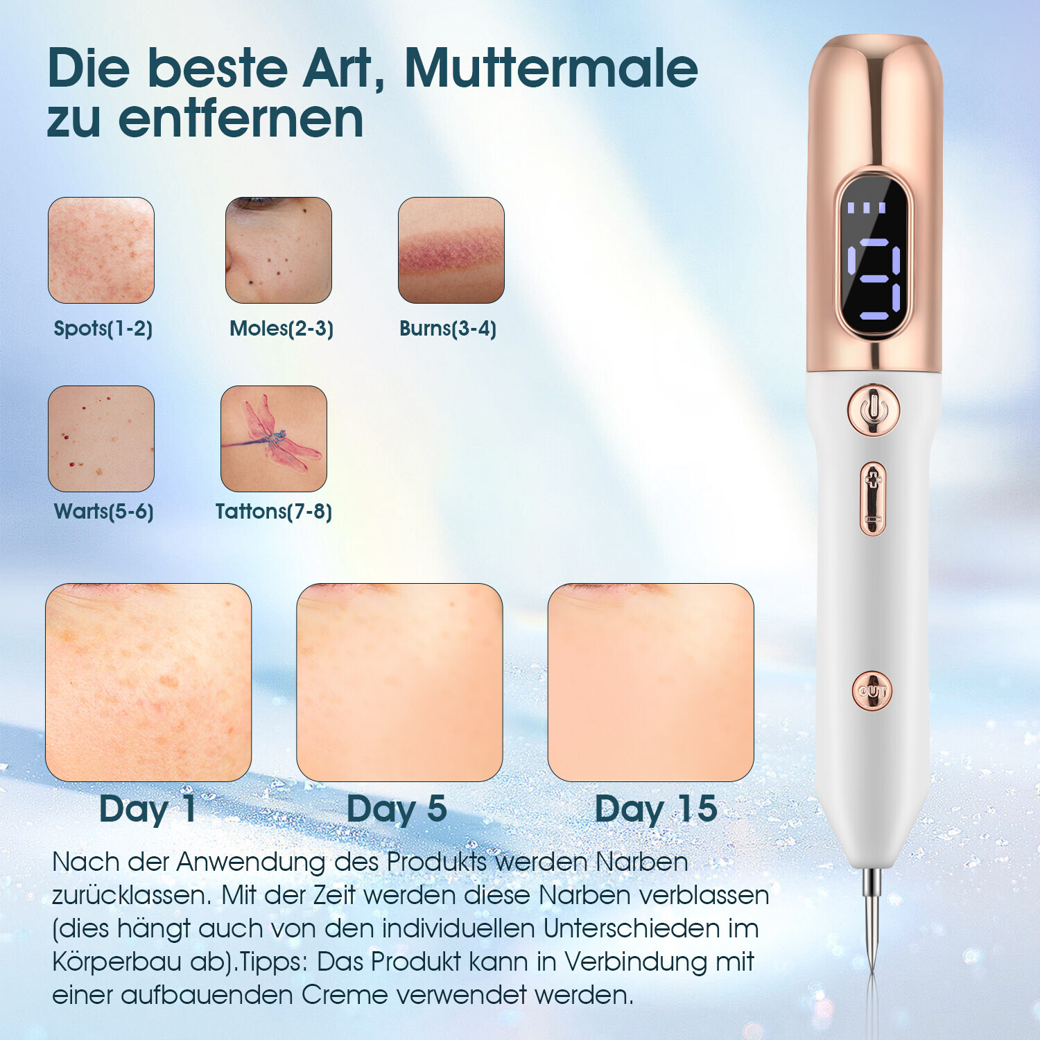 Bild 3 von 21