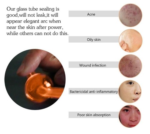 SALE!! Portable High Frequency Skin Care Acne Facial With 4 Wand Electrodes - Picture 6 of 10