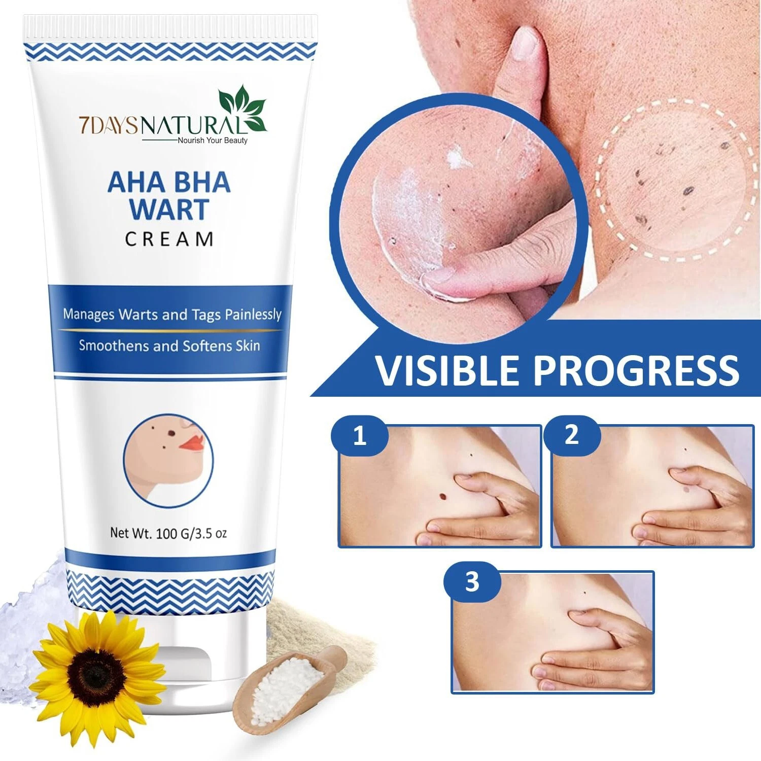 7 Days Natural AHA BHA Wart Remover Cream - 100 gm Fast Shipping