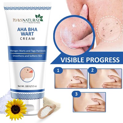 7 Days Natural AHA BHA Wart Remover Cream - 100 gm Fast Shipping