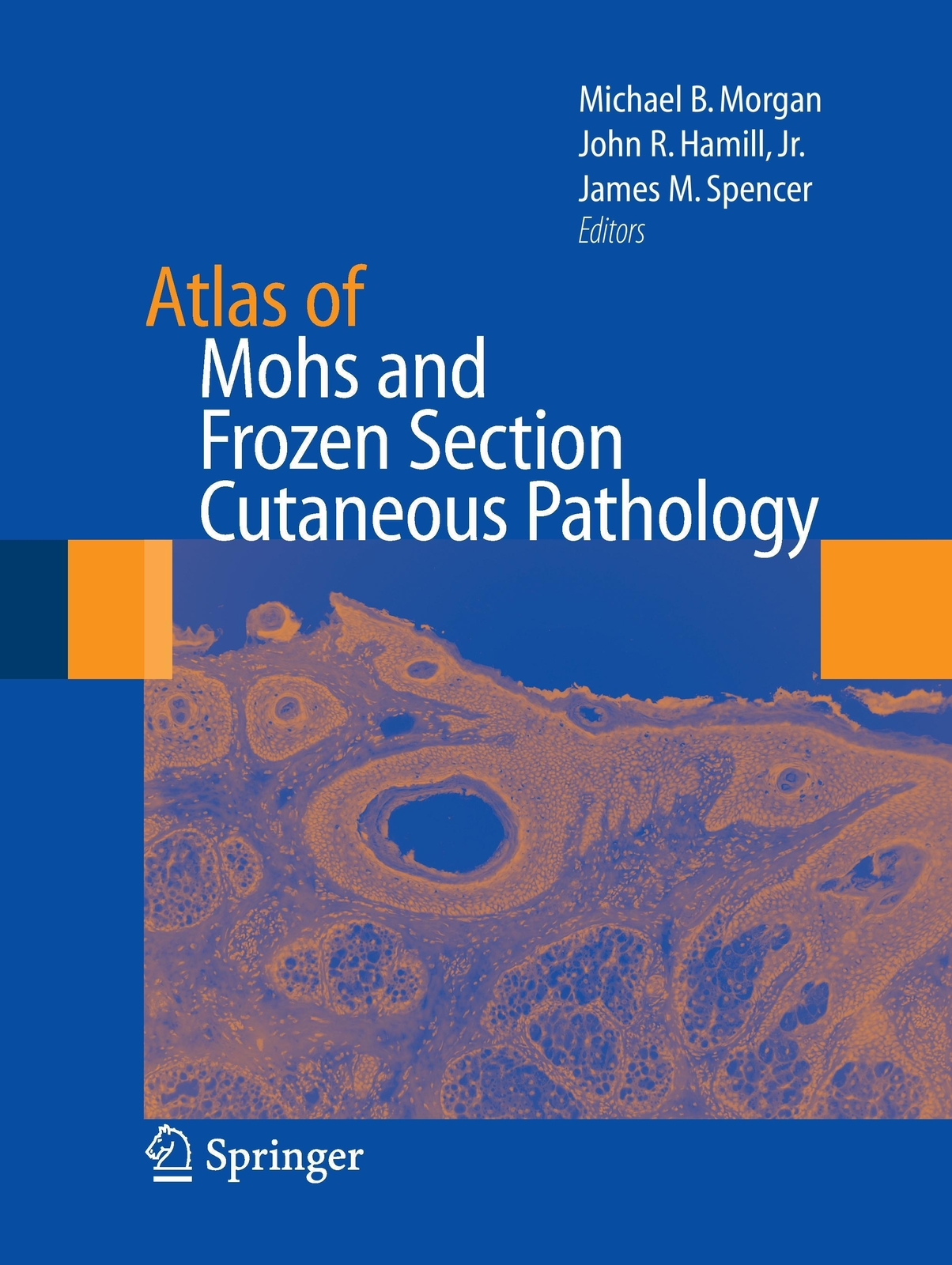 Thumbnail - Atlas Of Mohs And Frozen Section Cutaneous Pathology | Michael Morgan