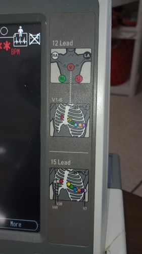 GE MAC 5500 Electrocardiogram (EKG) with Color Display - Picture 2 of 6