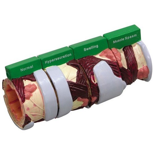 Bronchus GPI Anatomical Model 4-Piece LFA #3120.Make Us an Offer! SEE VIDEO - Picture 2 of 4