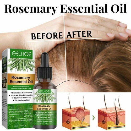 Rosemary Plant Extract Hair Growth Oil,Hair Growth Supplement For Women & Men | eBay Rosemary Plant Extract Hair Growth Oil,Hair Growth Supplement For Women & Men | eBay