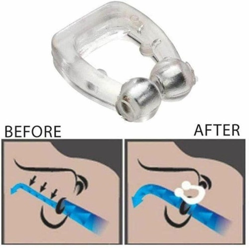 2Pcs Quiet and Comfortable Anti-Snore Clip for Restful Sleep, Snore Solution - Picture 2 of 9