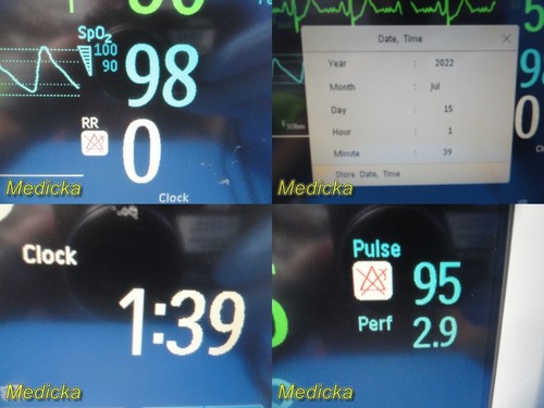 Philips Intellivue MP30 (M8002A) Monitor W/ M3001A Module & Patient Leads ~28881 - Picture 3 of 12