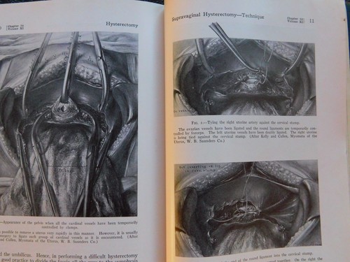 1928 Practice of Surgery - Vol X - Gynaecology (Genecology) - Bild 8 von 10