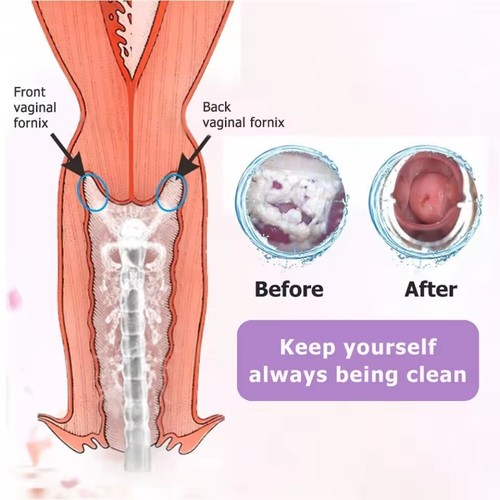 Kit limpiador bolsa enema goma riego colónico ducha bulbo vaginal anal 300 ml - Imagen 11 de 15