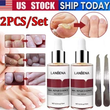 2x LANBENA Nail Repair Essence Remove Onychomycosis Serum Fungal Nail Treatment