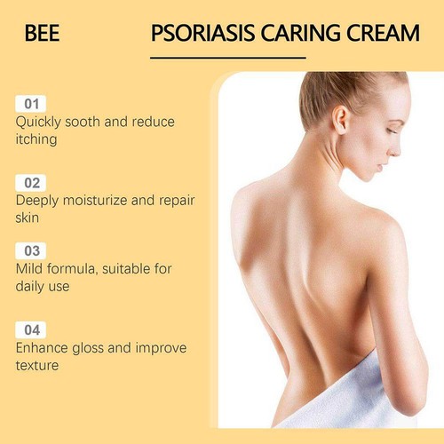 Bee Psoriasis Pflege Creme 30g N0K3 - Bild 8 von 12