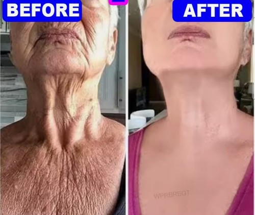 Suero blanqueador facial y corporal fuerte removedor de manchas oscuras ácido kójico 500 ml.[Stock de EE. UU. - Imagen 8 de 17