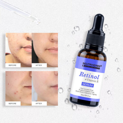 Retinol Face Serum + Vitamin E 30 ml Neutriherbs For Micro Needle Derma Roller - Picture 5 of 13