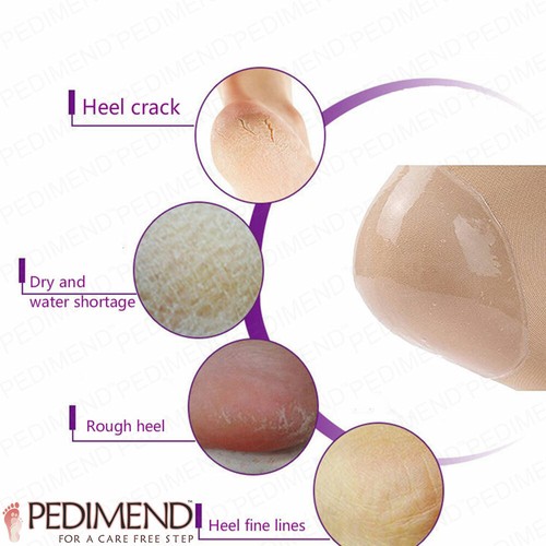 Pedimend Moisturizing Silicone Gel Heel Socks for Dry Hard Cracked Skin (2 PC) - Picture 7 of 7
