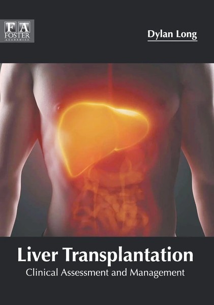 Dylan Long | Liver Transplantation | Buch | Englisch (2018) | Gebunden-image