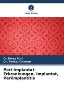 Peri-Implantat-Erkrankungen, Implantat, Periimplantitis Divya Puri (U. A.) Buch