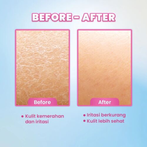 SCORA 2,5% D-PANTHENOL BARRIER SHIELD MOISTURIZER 40ml - Bild 5 von 5