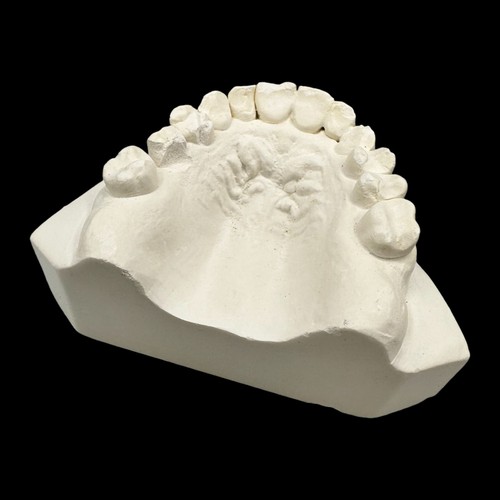 Vintage Plaster Dental Mold - Teeth Tooth Mold - Creepy Oddity - Dental Oddities - Foto 13 di 18